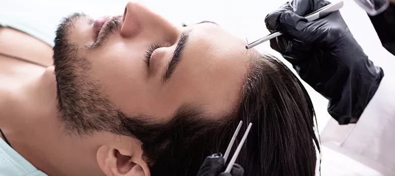 Hair Transplant Turkey: Where Quality Meets Affordability